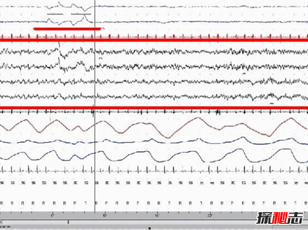做清醒梦都是些什么人?关于清醒梦的12个离奇事实