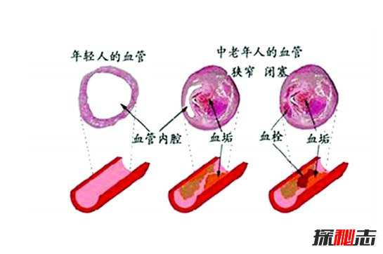 地龙的药用价值极高